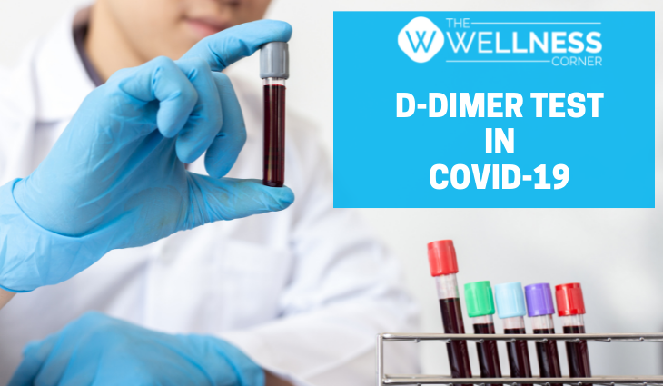 D-Dimer Tests: What is Their Role in Covid-19?