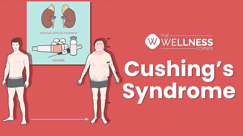 Cushing’s Syndrome, the hidden reason behind Chronic Stress, Hypertension & Diabetes Mellitus