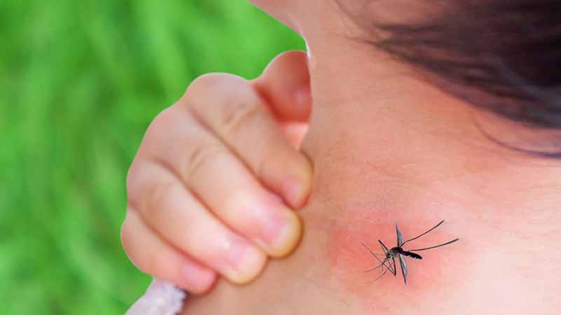 Break-bone dengue fever is back! Symptoms, diagnosis, treatment, and prevention