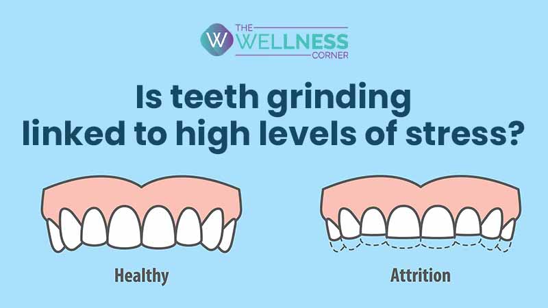 Teeth Grinding: Is Emotional Stability Related to Bruxism?