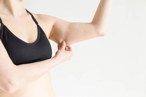 Fat woman armpit or underarm fat skin, woman diet lifestyle