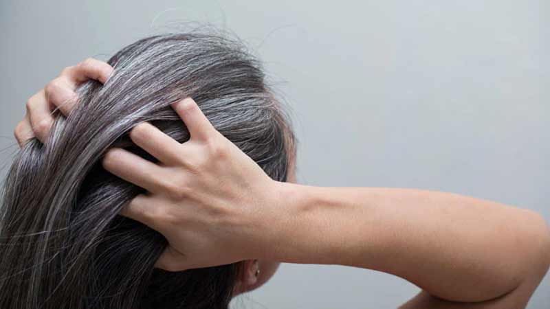 Natural Remedies to Conceal Gray Hair