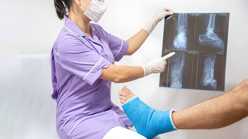 What Happens When A Fracture Doesn’t Heal Properly?